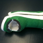 custom_-splint_2