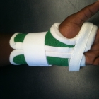 custom_-splint_3
